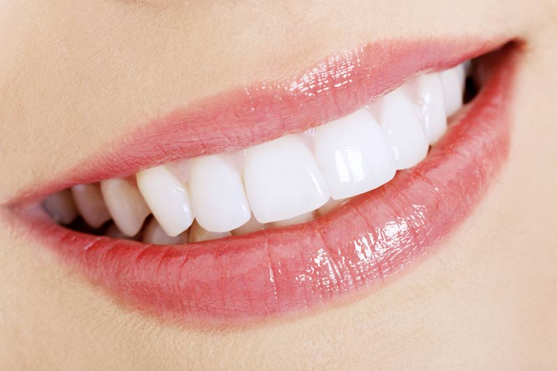 Cosmetic Dentistry in Woodland