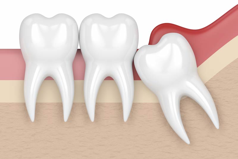 Orthodontics in Woodland